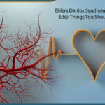 Ehlers-Danlos Syndrome (Vascular Eds): Things you should know!