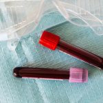 blood samples in vials